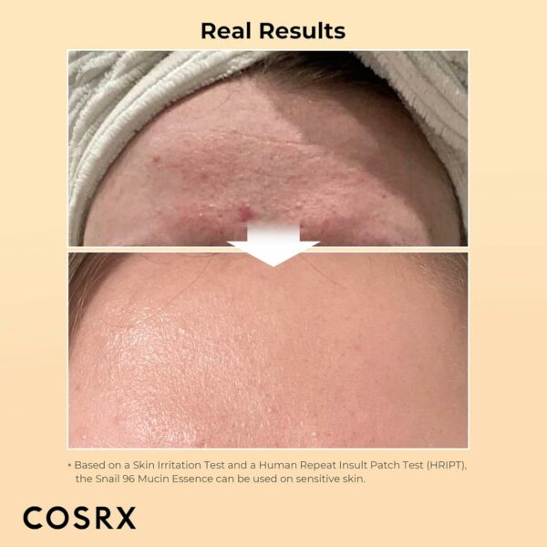 ⁦• CORSX Snail serum⁩ - الصورة ⁦3⁩