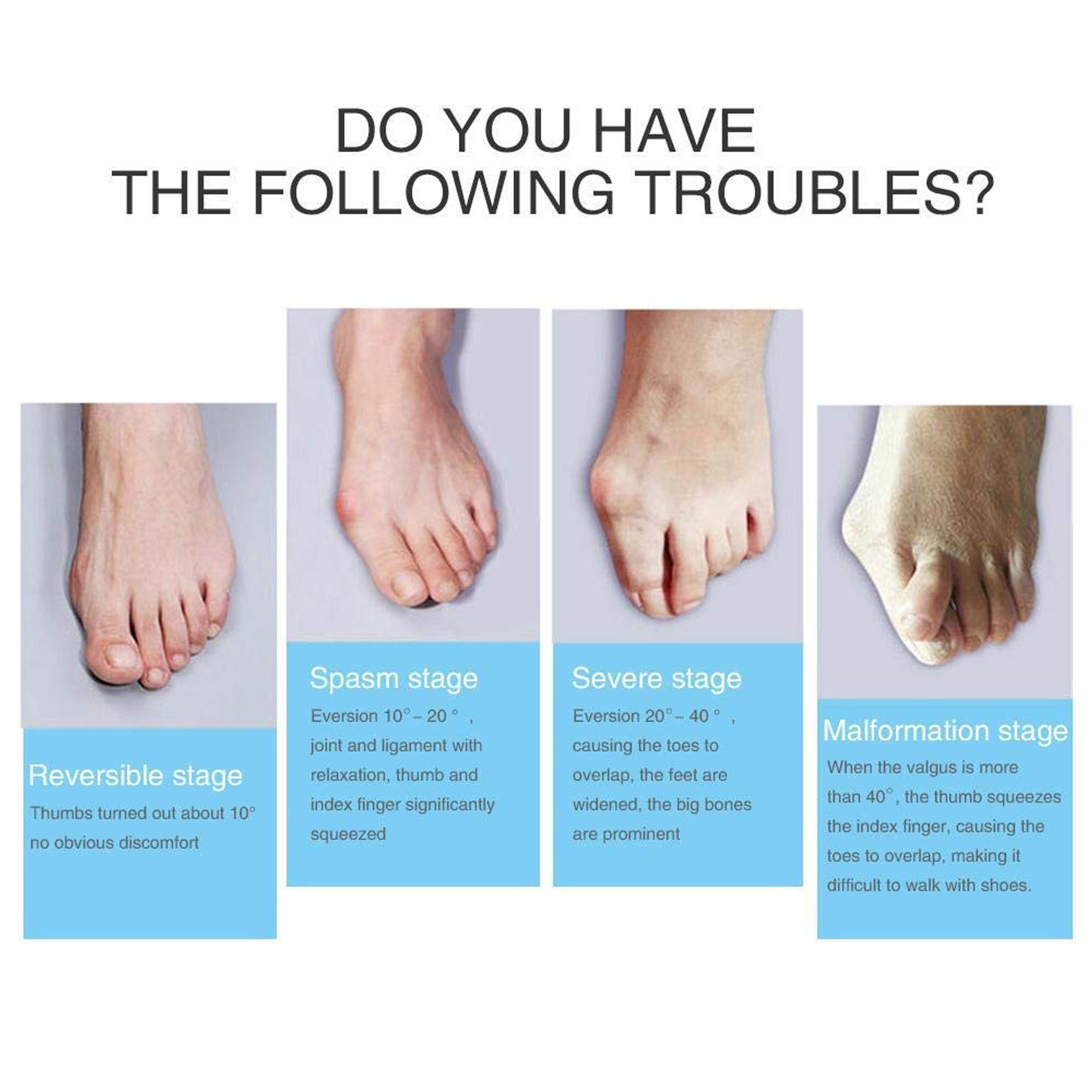 شراب فاصل مصحح إعوجاج اصبع القدم - الصورة 6